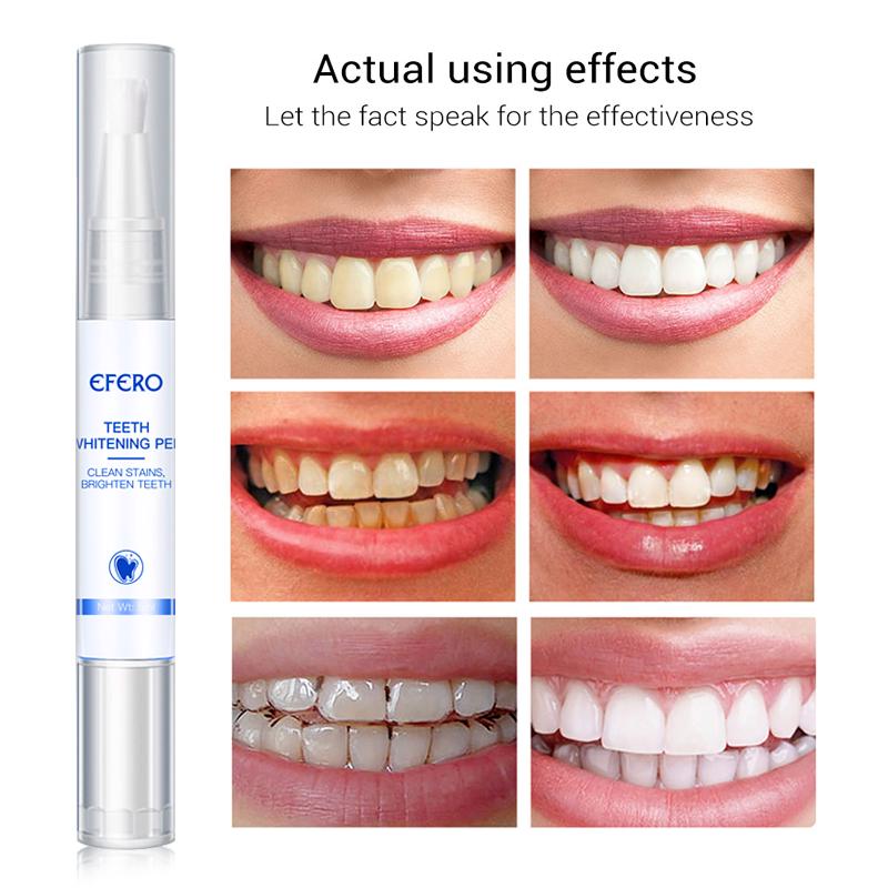 Perok za Izbjeljivanje Zubi White Teeth, Efero, 5ml